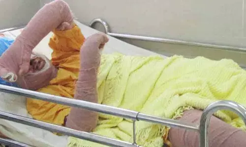 Woman football fan dies after setting herself on fire