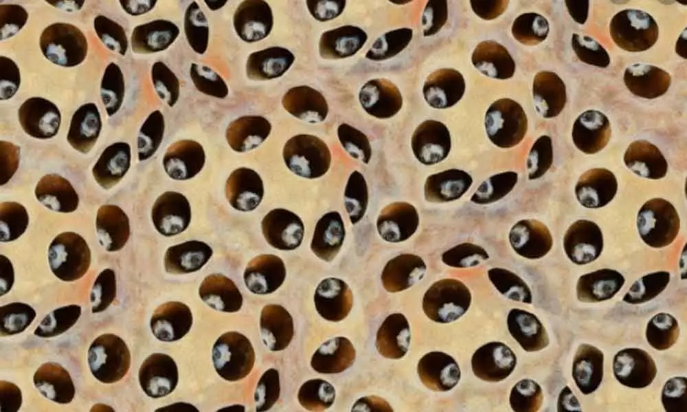 New iPhones are not for people with Trypophobia