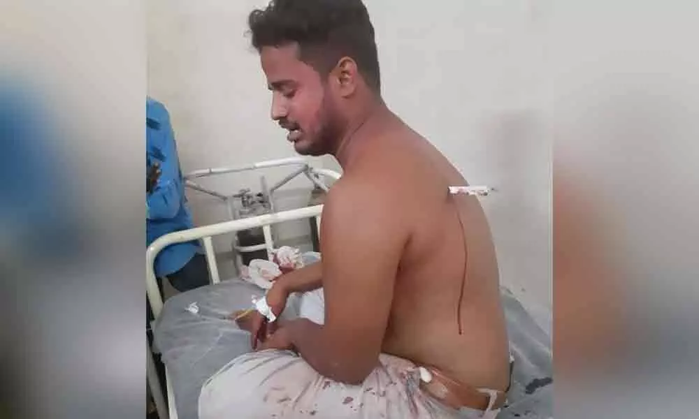 TDP activist hurt in attack in Jaggaiahpet