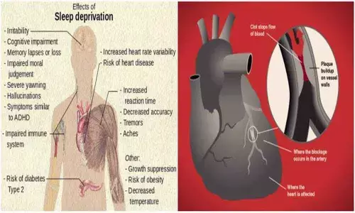 Insomnia raises risks of heart failure: Doctors