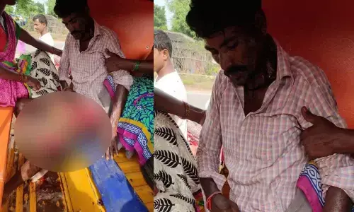 Farmer hurt in wild boar attack