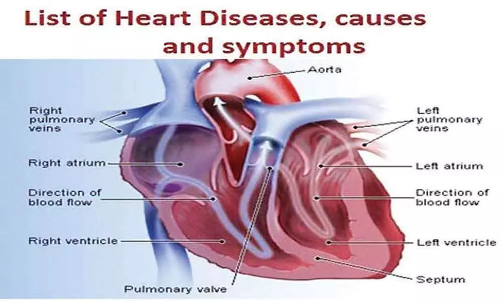 Heart failure is more fatal than heart attack