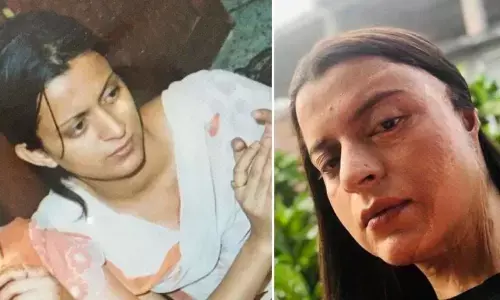 Kangana Ranauts sister, Rangoli Chandel shares her horrifying acid attack story and says her star sister was almost beaten to death