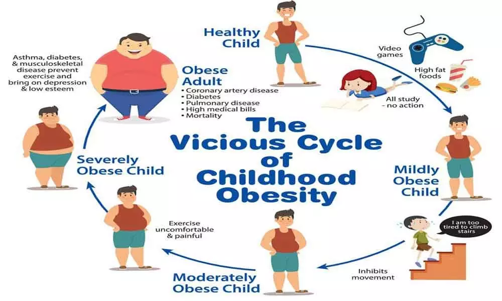 Childhood obesity now a major concern in hyderabad city