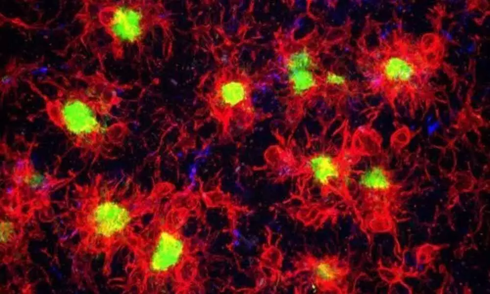 Immune cells rewire, repair brain while we sleep: Study