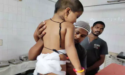 Canine creates panic, injures girl  in Rajamahendravaram