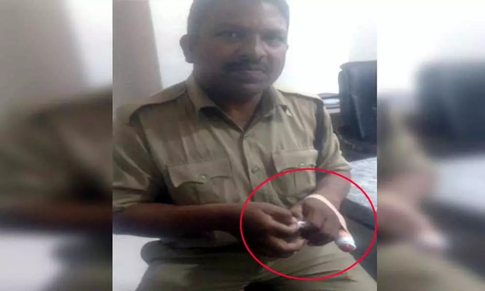 Drunk man bites off police constable finger in Khammam