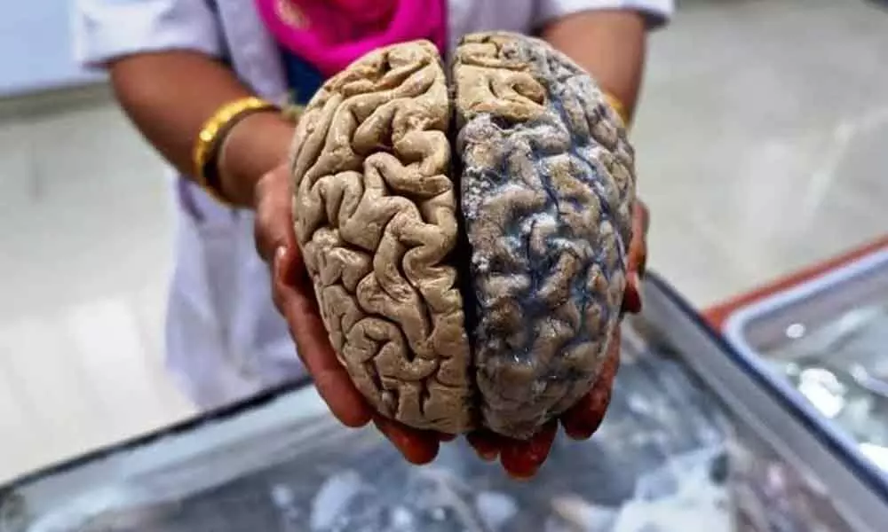 Indians have smaller brains compared to Caucasians and Chinese: Study