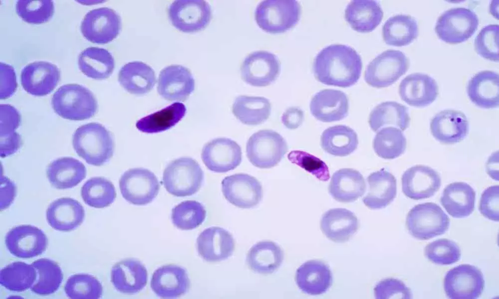 How malaria parasite prepares for infecting humans found