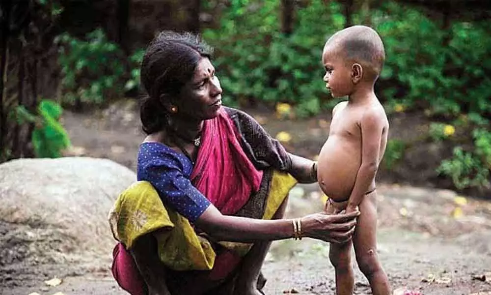 Bengal, UNICEF set 5-step agenda to fight malnutrition