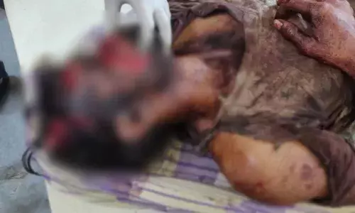 Man critically injured in bear attack in Nalgonda