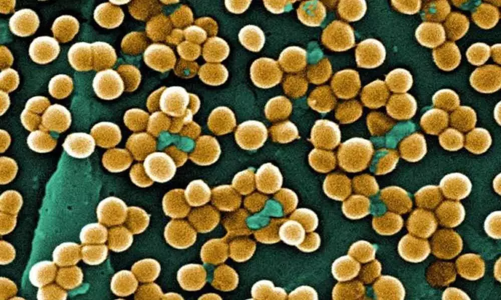 How potent bacterial toxin kills MRSA superbug found