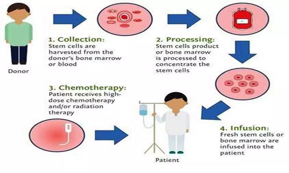 Bone Marrow Transplantation ops a godsend for thalassemia patients