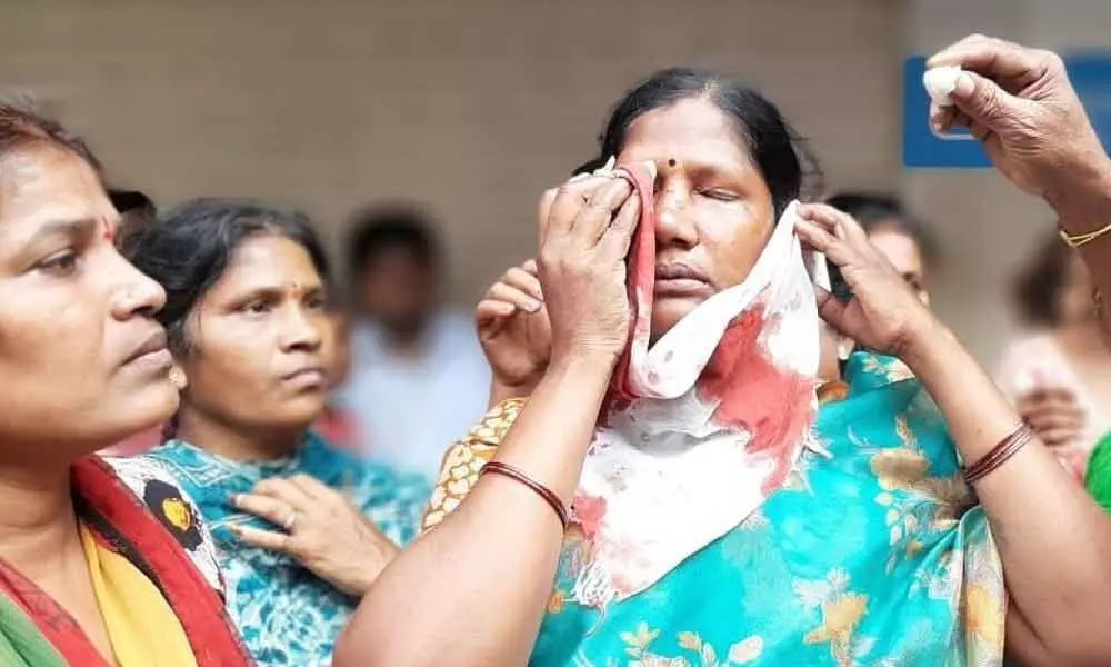 Women workers beaten to pulp by Khaki-clad men