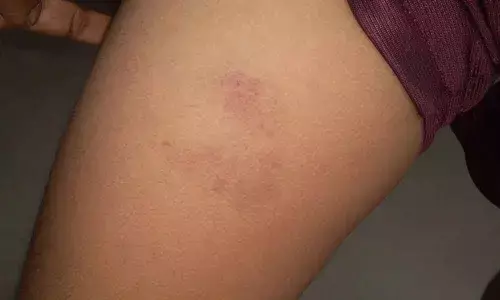 Boy, 7, thrashed by trader