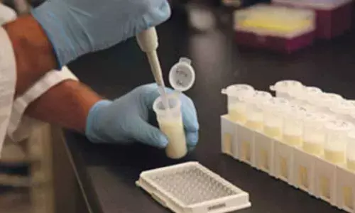 IIT-G researchers develop sensor to assess milk freshness