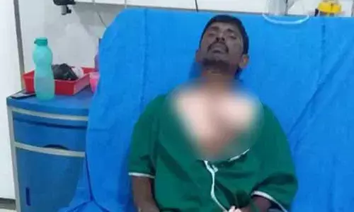 Another RTC worker suffers heart attack in Hyderabad