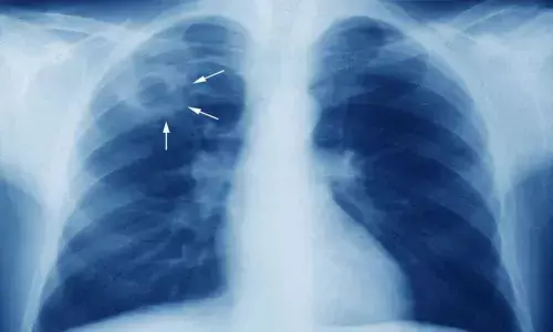 Awareness meet on Tuberculosis(TB) held in Huzurnagar