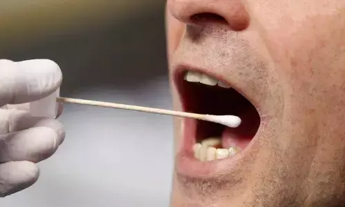 German police to eye 900 mens DNA seeking girls killer