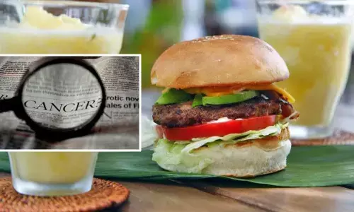 High-fat diet may increase colon cancer risk