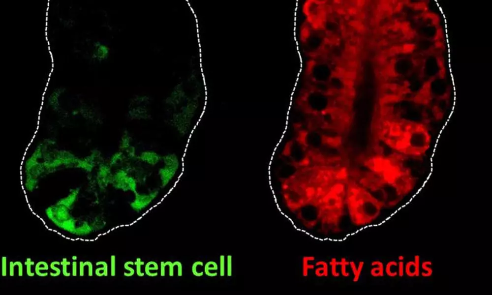 Intestinal stem cell can be linked with dietary fat and colon cancer: Research