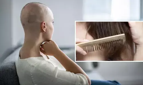 How donating your hair can be life-changing for a cancer patient