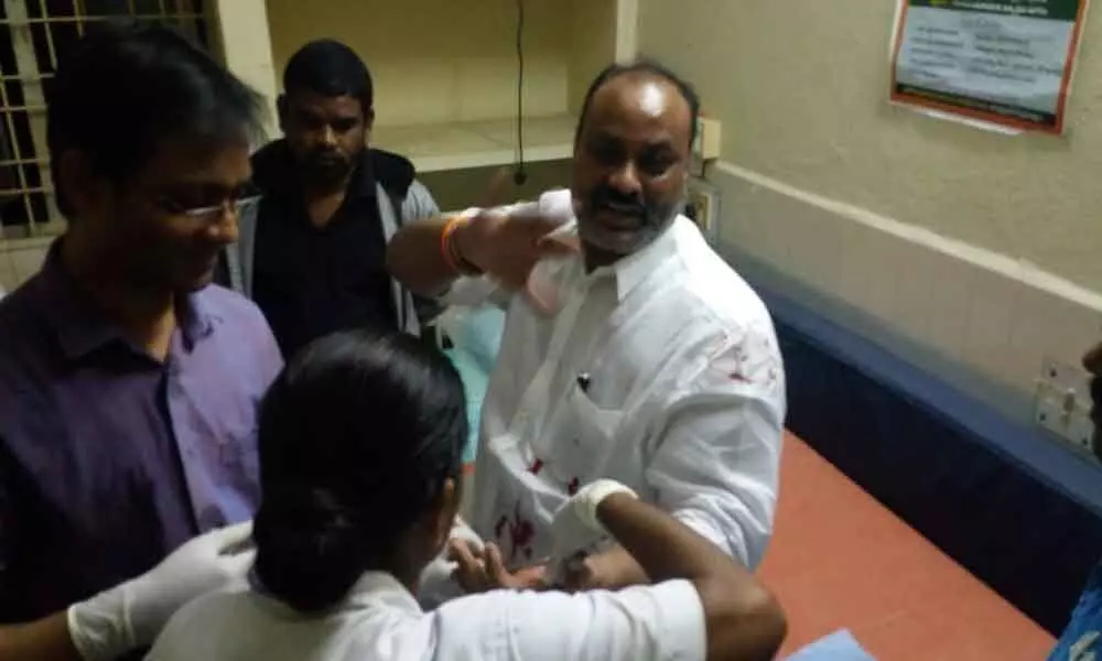 Former TDP Minister Atchannaidu met with road accident in Visakhapatnam