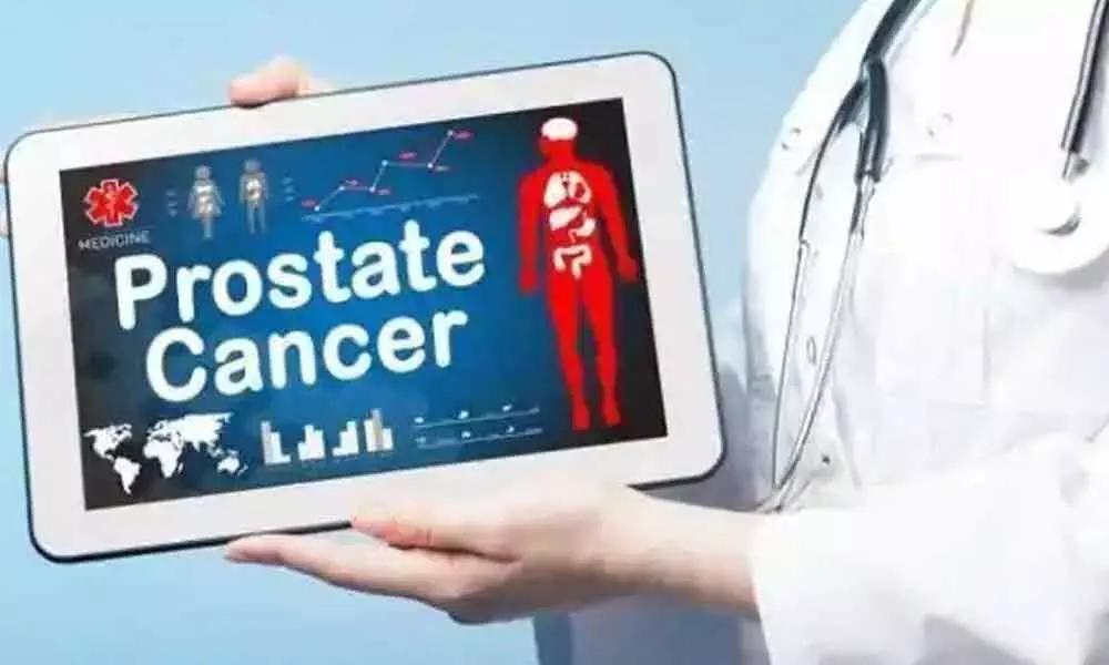 Simple testing method to detect prostate cancer for men