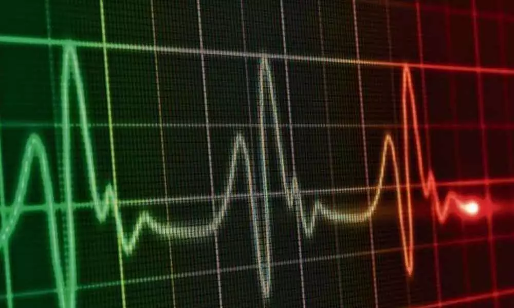 IIT Hyderabad develops device to monitor ECG data in real time