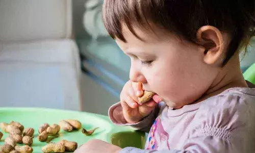 Introducing peanuts early to infants may prevent allergy development