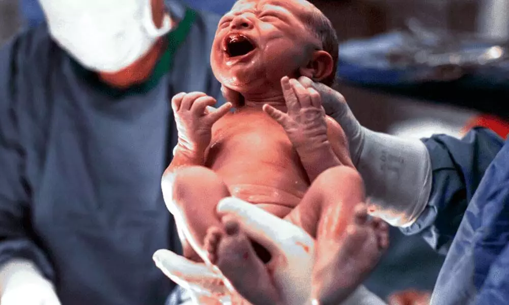 Kids born through C-sections not at higher obesity risk