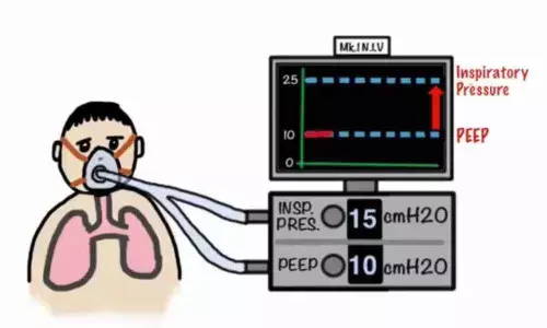 Hyderabad: Workshop held on Non-Invasive Ventilation
