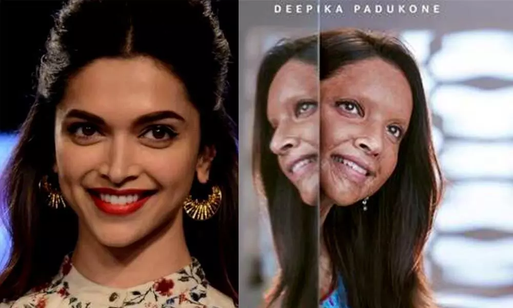 Chhapaak trailer: Deepika Padukone & Vikrant Masseys film will give you an all-new outlook towards life