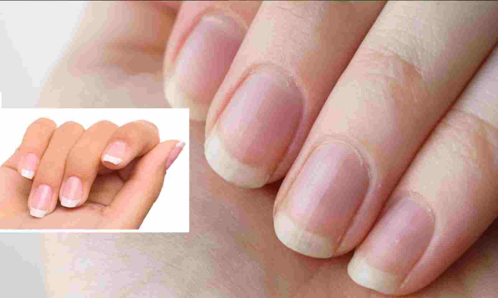 How To Grow Healthy Nails Radio Sargam