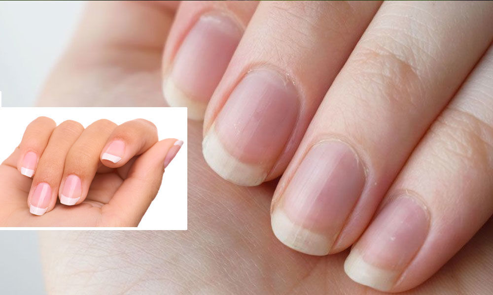 Vitamins for Nails Finger Nails speak a lot about your health