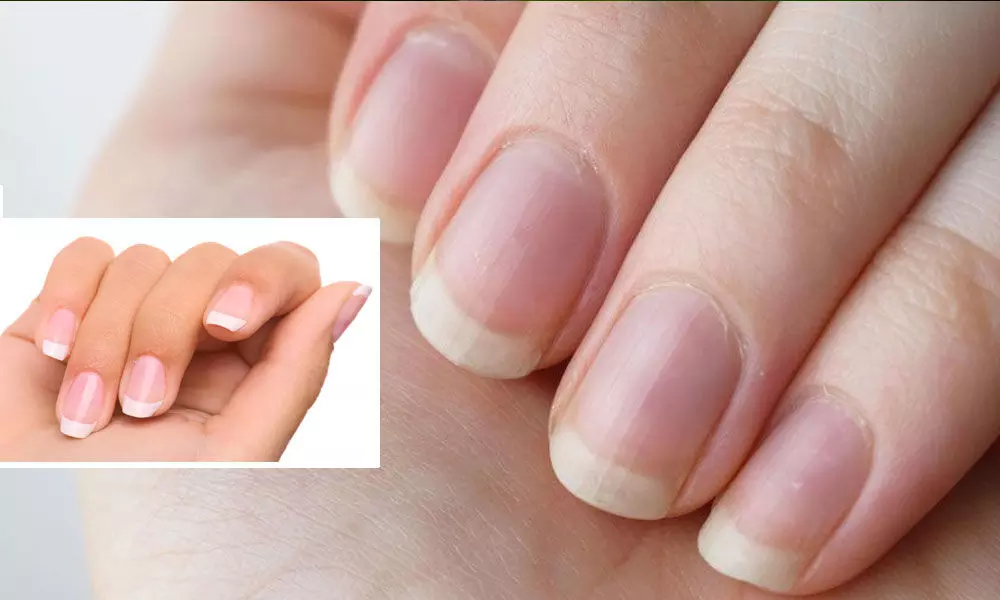 Keratin supplements: How they can support strong, healthy nails – Kiri10