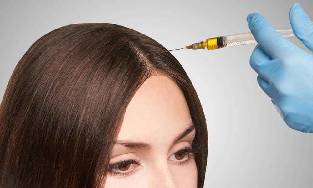 Hair Therapy: PRP Injections, Process, How it works and Results