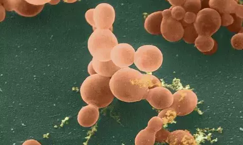 Protein that spurs bowel cancer growth identified