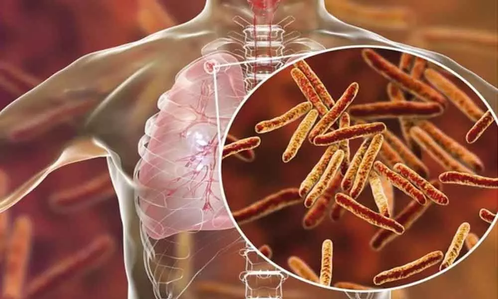 New approach improves the efficacy of TB vaccine: Study