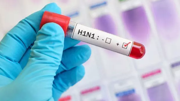 Patients with Swine flu symptoms need not be admitted in the hospital for collecting sample: Telangana Health Dept