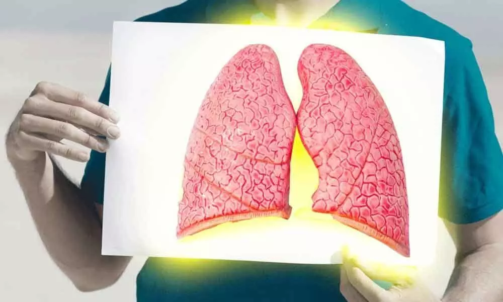 Cancer drugs may treat lung inflammation: Study