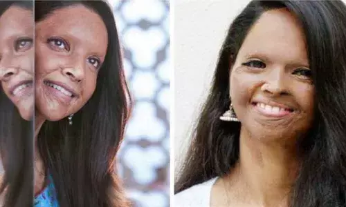 Smritis Chhapaak on Deepika