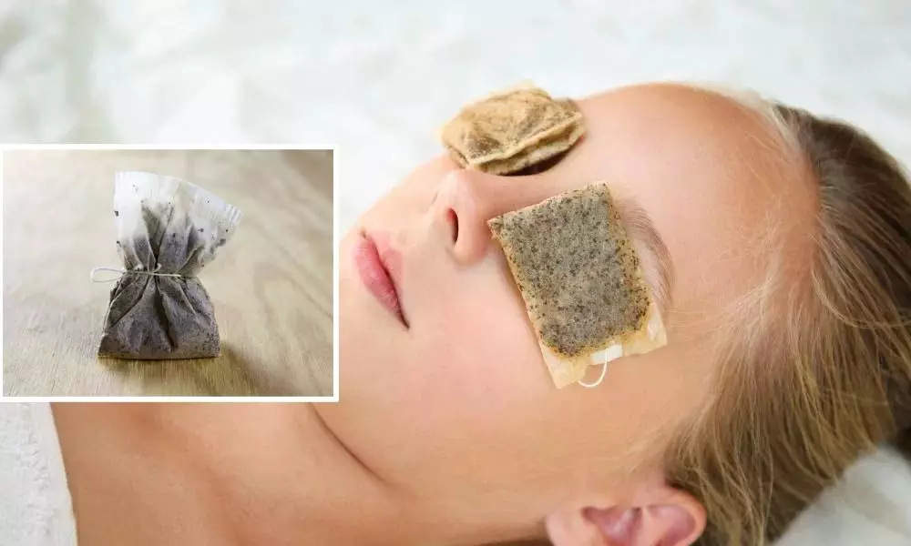 Awesome benefits of used tea bags for your beauty woes