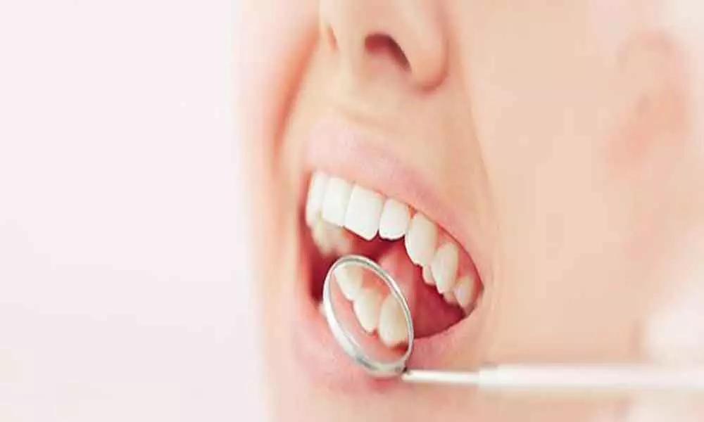 Hong Kong: New teeth gel may prevent dental cavities, tooth decay