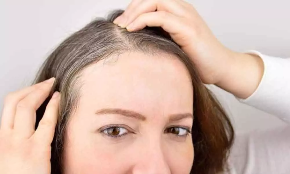 Heres What Finally Helped My Hair Loss From Stress  HUM Nutrition Blog