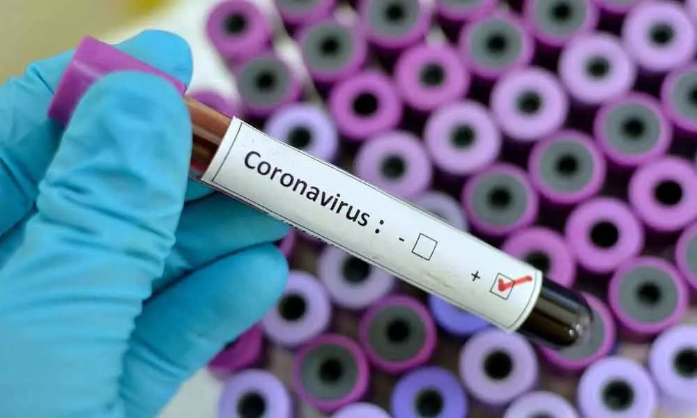 26 dead in China with Coronavirus : 2 under watch in Mumbai
