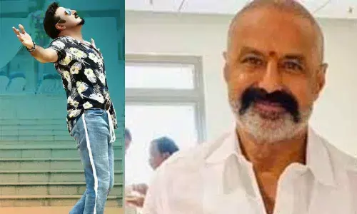 Balakrishna mulls hair transplant?