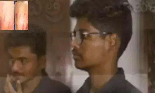 Two junior students injured in seniors attack at RIMS Medical college in Srikakulam district