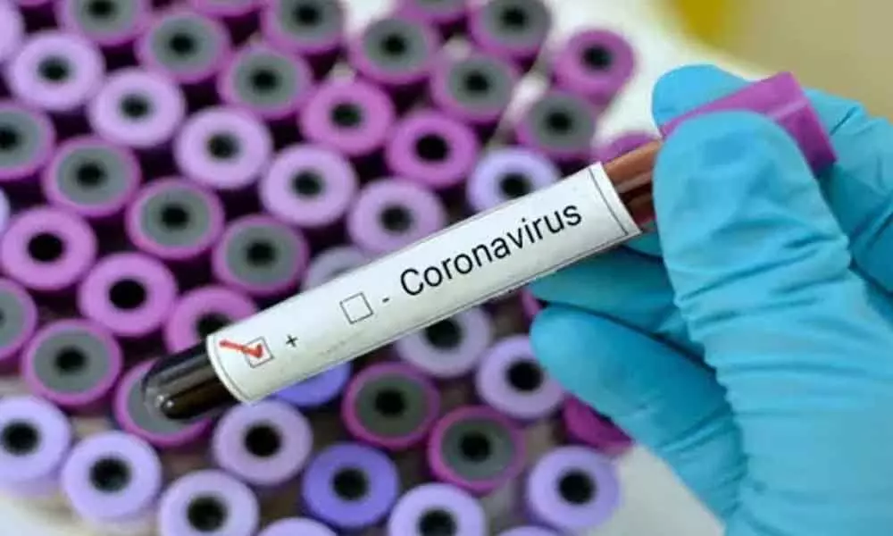 Guntur: Awareness campaign on Coronavirus held