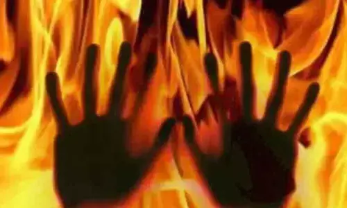 Man set fire on mother-in-law over dispute with wife in Nellore district